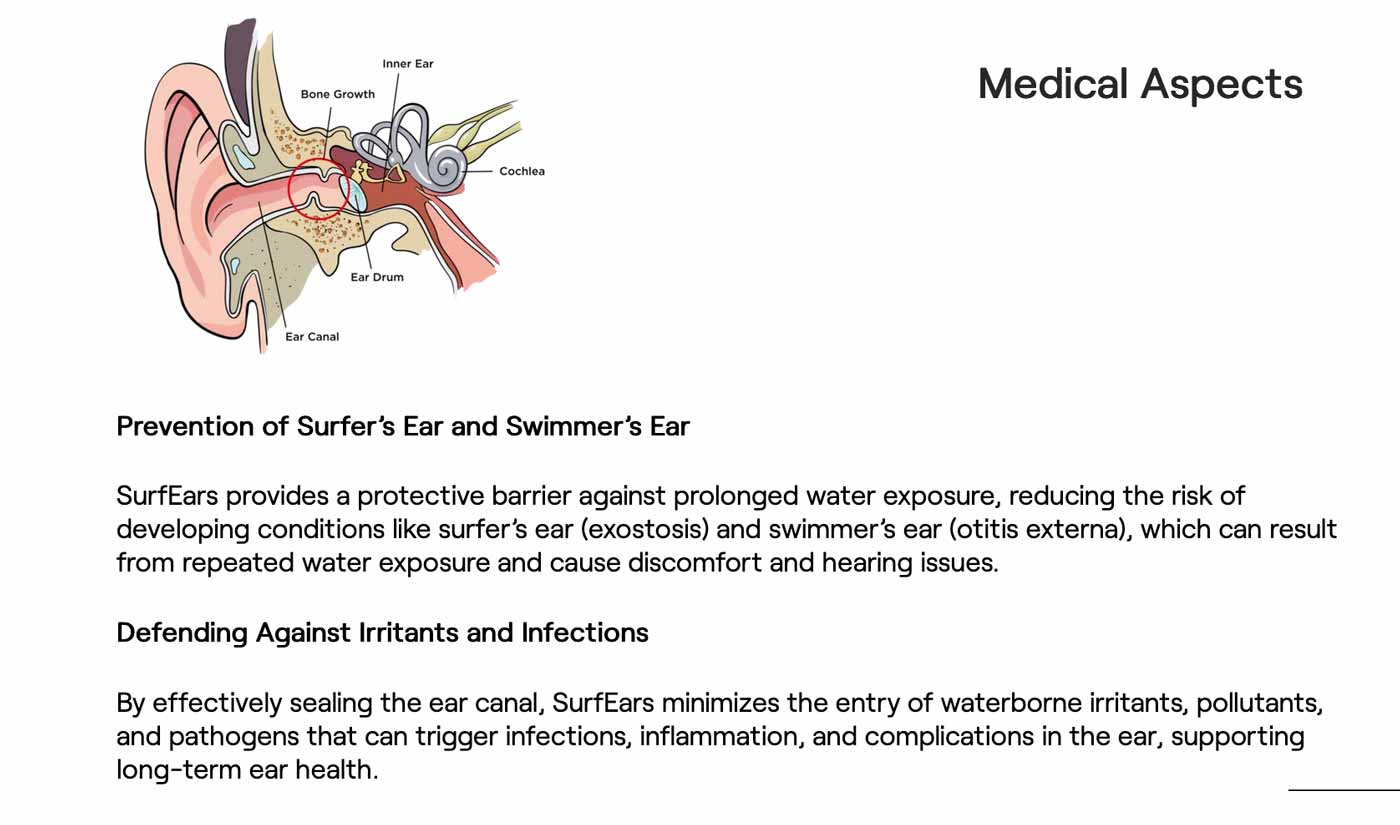 SurfEars 4.0 Earplugs – Black Sage